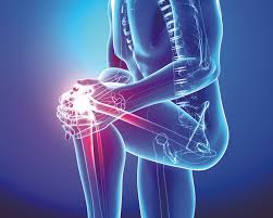 Orthopaedics